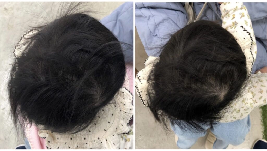 7ヶ月 初回の変化(Before/After)